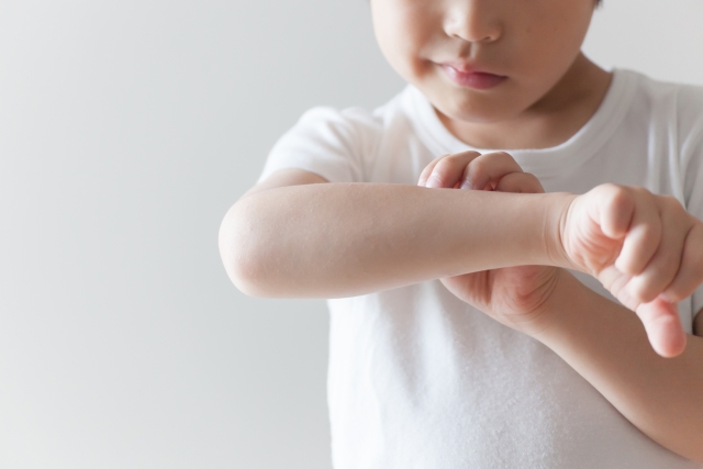 害虫駆除:蚊に刺されて腕を痒がる手男の子